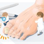 高齢者の足の爪には色々とトラブルがある？原因と特徴、予防法について解説