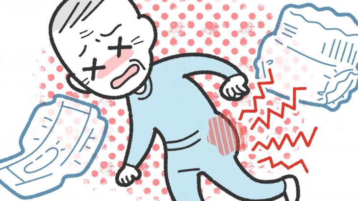 高齢者の皮膚のかぶれ（接触皮膚炎）とは？初期症状やオムツかぶれ・蒸れ対策をベテラン介護士が解説